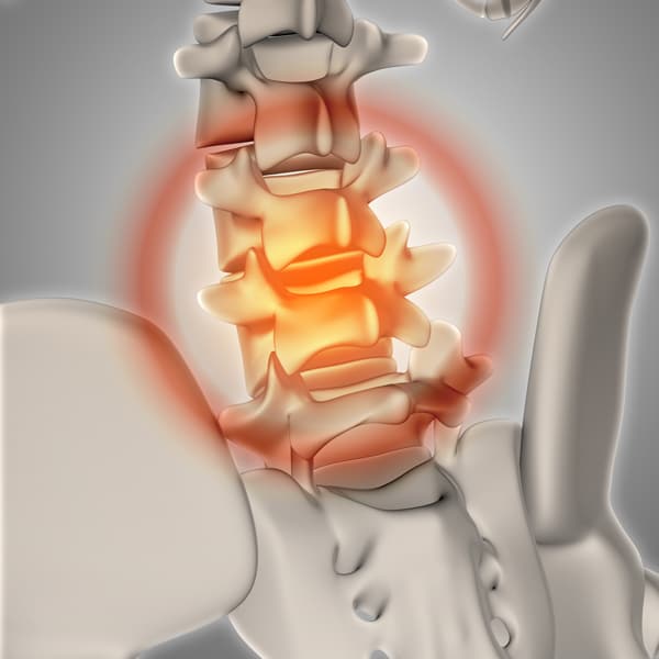Contact our chiropractic office if you are suffering from bulging disc