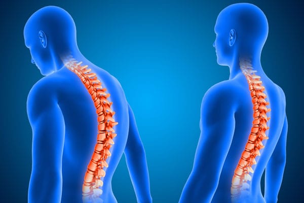Get help from Murfreesboro chiropractor to correct your posture.