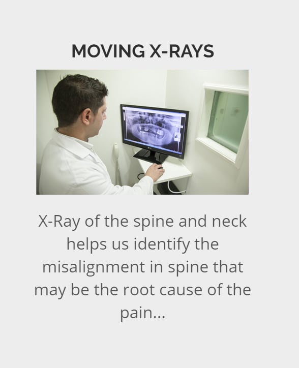 X-ray helps Chiropractors identify the misalignment in Spine